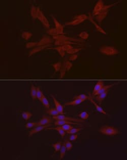 Invitrogen S100A10 Polyclonal Antibody 100 μL; Unconjugated:Antibodies,