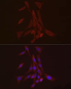 Invitrogen S100A10 Polyclonal Antibody 100 μL; Unconjugated:Antibodies,