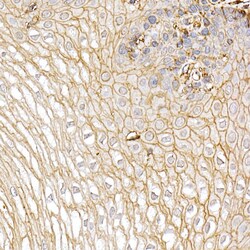 Invitrogen S100A10 Polyclonal Antibody 100 μL; Unconjugated:Antibodies,