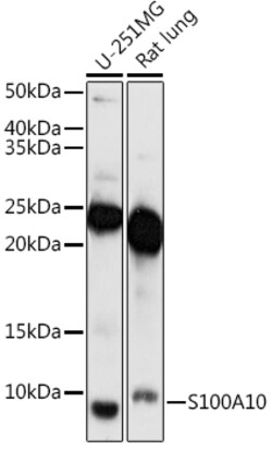 Invitrogen S100A10 Polyclonal Antibody 100 μL; Unconjugated:Antibodies,