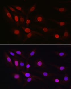 Invitrogen SP1 Polyclonal Antibody 100 &mu;L; Unconjugated:Antibodies,