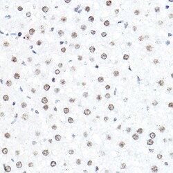 Invitrogen SP1 Polyclonal Antibody 100 &mu;L; Unconjugated:Antibodies,