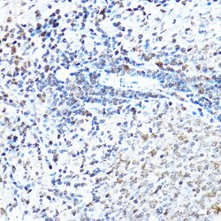 Invitrogen SP1 Polyclonal Antibody 100 &mu;L; Unconjugated:Antibodies,