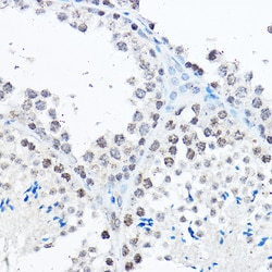 Invitrogen SP1 Polyclonal Antibody 100 &mu;L; Unconjugated:Antibodies,
