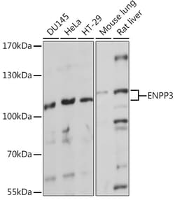 Invitrogen CD203c Polyclonal Antibody 100 &mu;L | Buy Online | Invitrogen&trade; | Fisher Scientific