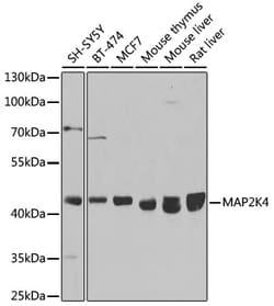 Invitrogen MAP2K4 Polyclonal Antibody 100 μL; Unconjugated:Antibodies,