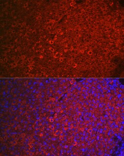Invitrogen FSHR Polyclonal Antibody 100 &mu;L; Unconjugated:Antibodies,