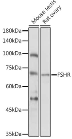 Invitrogen FSHR Polyclonal Antibody 100 &mu;L; Unconjugated:Antibodies,