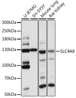 Invitrogen SLC4A8 Polyclonal Antibody 100 &mu;L | Buy Online | Invitrogen&trade; | Fisher Scientific