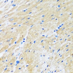 Invitrogen BAG3 Polyclonal Antibody 100 &mu;L; Unconjugated:Antibodies,