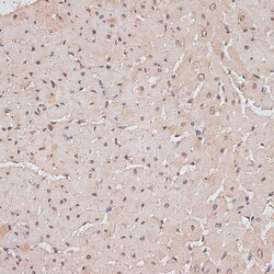 Invitrogen TLK1 Polyclonal Antibody 100 &mu;L; Unconjugated:Antibodies,