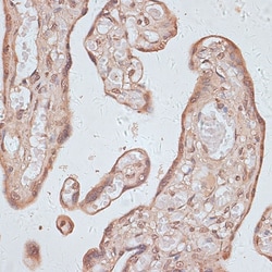 Invitrogen TLK1 Polyclonal Antibody 100 &mu;L; Unconjugated:Antibodies,