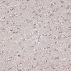 Invitrogen TLK1 Polyclonal Antibody 100 &mu;L; Unconjugated:Antibodies,