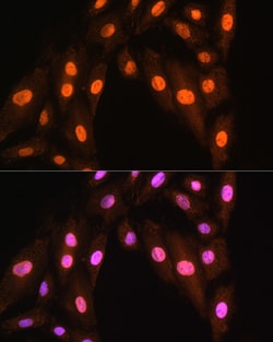 Invitrogen BRMS1 Polyclonal Antibody 100 &mu;L; Unconjugated:Antibodies,