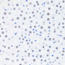 Invitrogen BRMS1 Polyclonal Antibody 100 &mu;L; Unconjugated:Antibodies,