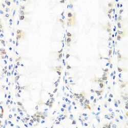 Invitrogen BRMS1 Polyclonal Antibody 100 &mu;L; Unconjugated:Antibodies,