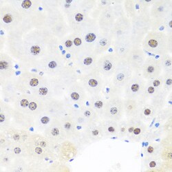Invitrogen BRMS1 Polyclonal Antibody 100 &mu;L; Unconjugated:Antibodies,