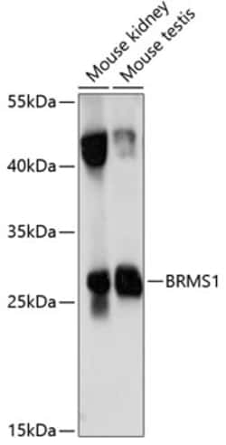 Invitrogen BRMS1 Polyclonal Antibody 100 &mu;L; Unconjugated:Antibodies,