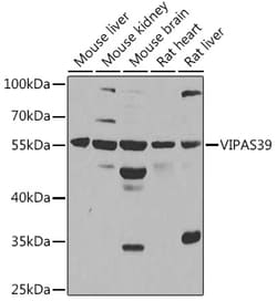 Invitrogen VIPAS39 Polyclonal Antibody 100 &mu;L; Unconjugated:Antibodies,