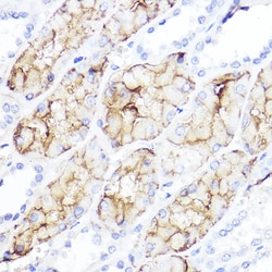Invitrogen Aquaporin 1 Polyclonal Antibody 100 &mu;L; Unconjugated:Antibodies,