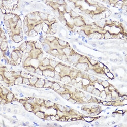 Invitrogen Aquaporin 1 Polyclonal Antibody 100 &mu;L; Unconjugated:Antibodies,