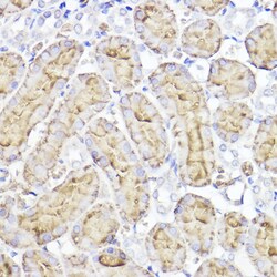 Invitrogen Aquaporin 1 Polyclonal Antibody 100 &mu;L; Unconjugated:Antibodies,