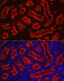 Invitrogen Aquaporin 1 Polyclonal Antibody 100 &mu;L; Unconjugated:Antibodies,