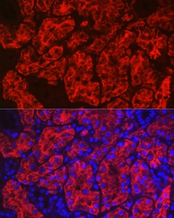 Invitrogen Aquaporin 1 Polyclonal Antibody 100 &mu;L; Unconjugated:Antibodies,