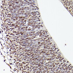 Invitrogen TET1 Polyclonal Antibody 100 μL; Unconjugated:Antibodies,