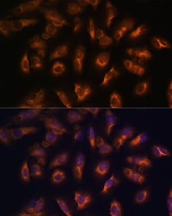 Invitrogen SSTR2 Polyclonal Antibody 100 &mu;L; Unconjugated:Antibodies,