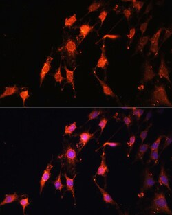 Invitrogen PRR5 Polyclonal Antibody 100 &mu;L; Unconjugated:Antibodies,