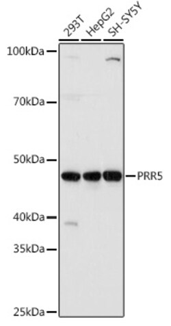 Invitrogen PRR5 Polyclonal Antibody 100 &mu;L; Unconjugated:Antibodies,