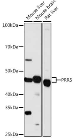 Invitrogen PRR5 Polyclonal Antibody 100 &mu;L; Unconjugated:Antibodies,