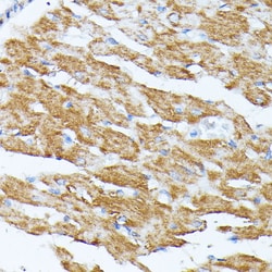 Invitrogen Kir4.2 (KCNJ15) Polyclonal Antibody 100 &mu;L; Unconjugated:Antibodies,
