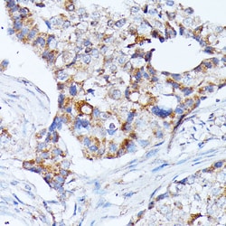Invitrogen Kir4.2 (KCNJ15) Polyclonal Antibody 100 &mu;L; Unconjugated:Antibodies,