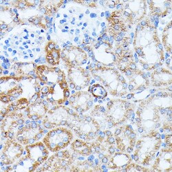Invitrogen Kir4.2 (KCNJ15) Polyclonal Antibody 100 &mu;L; Unconjugated:Antibodies,