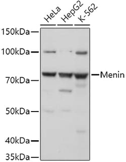 Invitrogen Menin Polyclonal Antibody 100 &mu;L; Unconjugated:Antibodies,