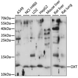 Invitrogen Oxytocin Polyclonal Antibody 100 &mu;L | Buy Online | Invitrogen&trade; | Fisher Scientific