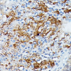 Invitrogen RNASE6 Polyclonal Antibody 100 &mu;L; Unconjugated:Antibodies,