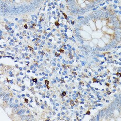 Invitrogen RNASE6 Polyclonal Antibody 100 &mu;L; Unconjugated:Antibodies,