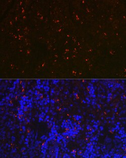 Invitrogen RNASE6 Polyclonal Antibody 100 &mu;L; Unconjugated:Antibodies,