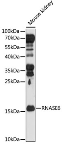 Invitrogen RNASE6 Polyclonal Antibody 100 &mu;L; Unconjugated:Antibodies,