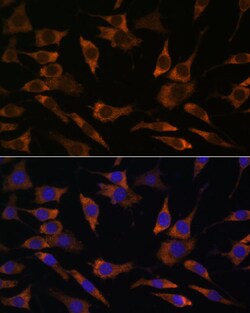 Invitrogen RPS25 Polyclonal Antibody 100 &mu;L; Unconjugated:Antibodies,