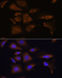 Invitrogen RPS25 Polyclonal Antibody 100 &mu;L; Unconjugated:Antibodies,