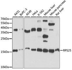 Invitrogen RPS25 Polyclonal Antibody 100 &mu;L; Unconjugated:Antibodies,