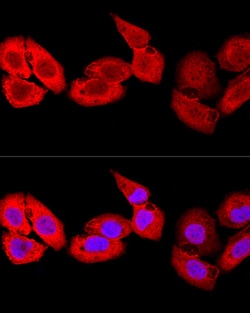 Invitrogen S100A8 Polyclonal Antibody 100 &mu;L; Unconjugated:Antibodies,