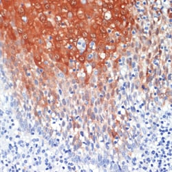 Invitrogen S100A8 Polyclonal Antibody 100 &mu;L; Unconjugated:Antibodies,