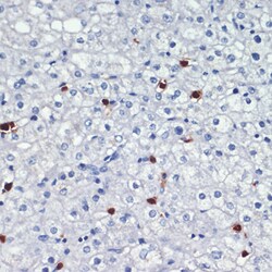 Invitrogen S100A8 Polyclonal Antibody 100 &mu;L; Unconjugated:Antibodies,