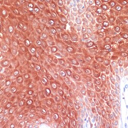 Invitrogen S100A8 Polyclonal Antibody 100 &mu;L; Unconjugated:Antibodies,