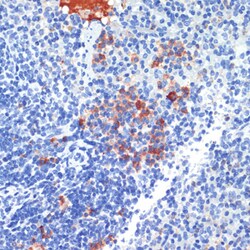 Invitrogen S100A8 Polyclonal Antibody 100 &mu;L; Unconjugated:Antibodies,